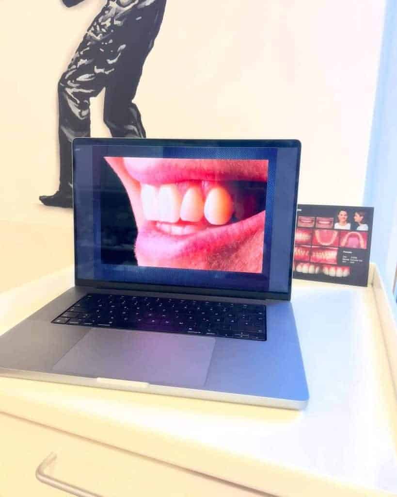 Teamfortbildung Dentalfotografie