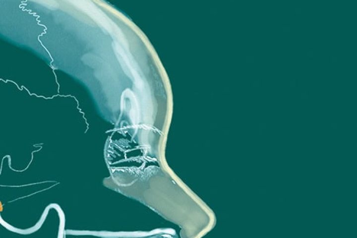 Kieferorthopaede cologne - JUST KFO - Dr. Steinmaier + Kollegen - Aligner Orthodontics and Orofacial Orthopedics