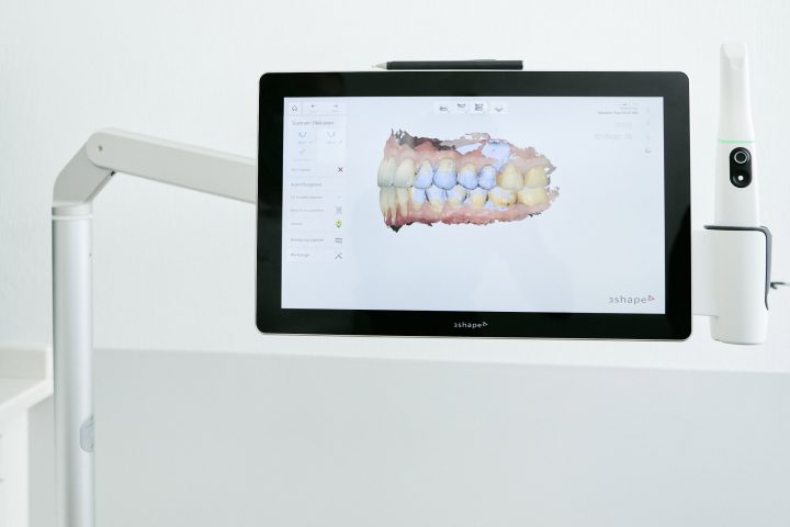 Kieferorthopaede Koeln - JUST KFO - Dr. Steinmaier + Kollegen - Digitale Kieferorthopaedie