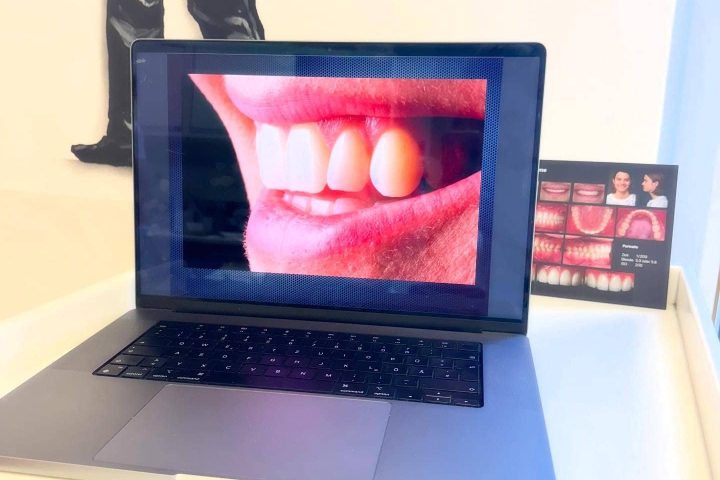 Kieferorthopaede cologne - JUST KFO - Dr. Steinmaier + Kollegen - Advanced training in intraoral dental photography